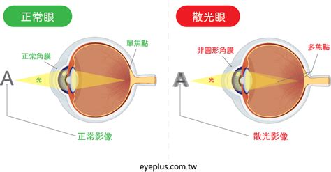 晚上看燈光會散開|散光是什麼？一次了解散光症狀、治療以及如何預防